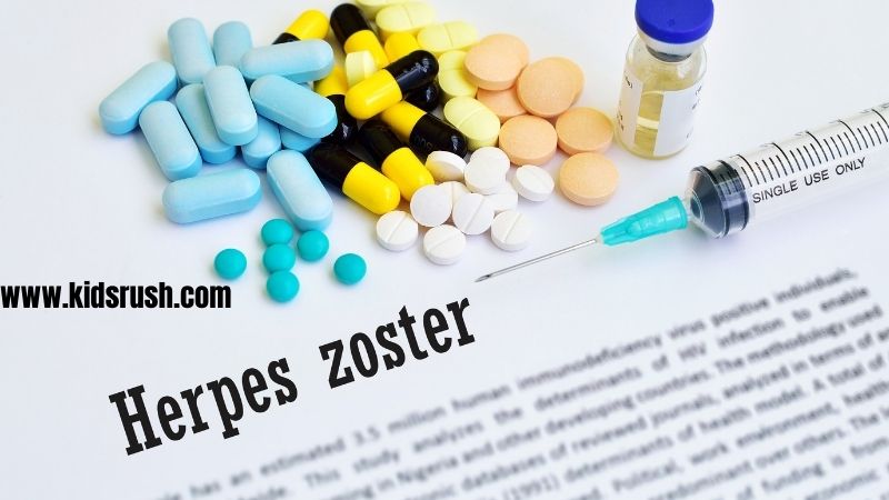 Causes of herpes zoster in children