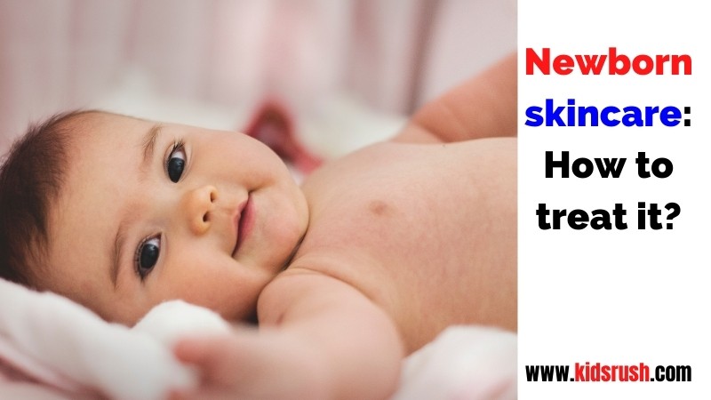 Newborn skincare: How to treat it?