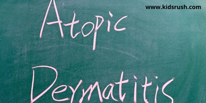 pictures of atopic dermatitis in infants