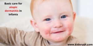 Basic care for atopic dermatitis in infants - Kidsrush.com