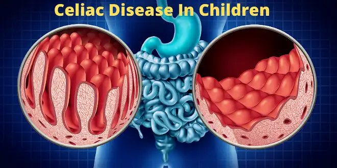 causes of Celiac-Disease-In-Children