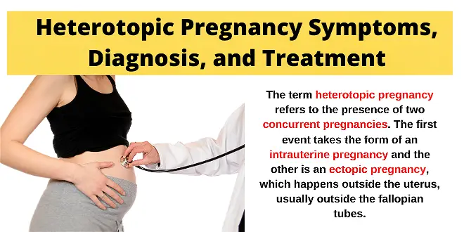 Heterotopic Pregnancy