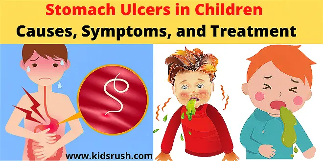 Stomach Ulcers in Children
