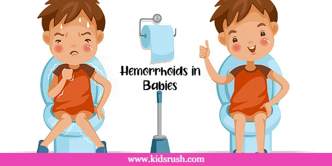 Hemorrhoids in Babies: Causes, Symptoms and Treatment