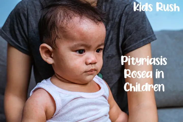 Pityriasis Rosea in Children: Causes, Symptoms and Treatment
