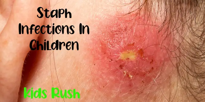 Staph Infections In Children
