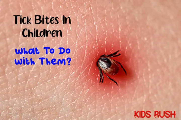 Tick Bites In Children